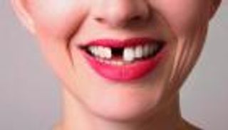 اعرف عمرك من أسنانك