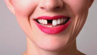 اهتم بصحة أسنانك لتحافظ على عمرك