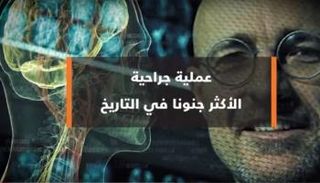 العملية الجراحية الأكثر جنونا في التاريخ