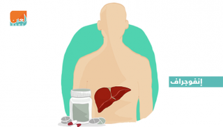 أكثر الأمراض شيوعاً في العالم