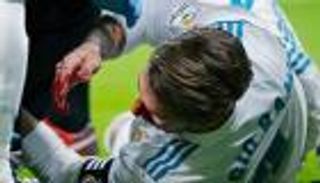 راموس يتراجع عن إجراء جراحة بسبب الريال