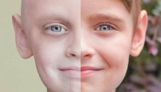 طفل مصاب بالسرطان - أرشيفية