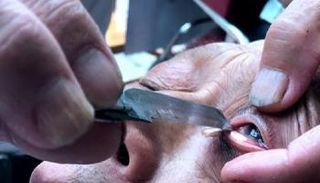 تنظيف مقلة العين بشفرات الحلاقة