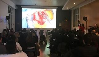 العملية الجراحية بثتها وكالات الأنباء عبر مواقعها