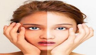 طريقة تفتيح البشرة