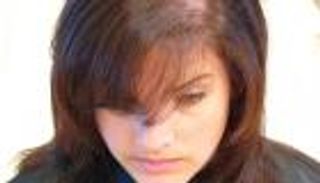  أسباب وأعراض الثعلبة وعلاجها‎‏