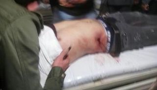 صورة نشره المركز للإصابات بالرصاص