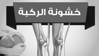 خشونة الركبة تسبب آلاما مبرحة