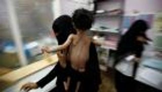 "الجارديان": شبح المجاعة يطل برأسه في 4 دول منها اليمن