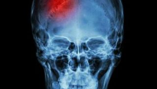 جمجمة بشرية 