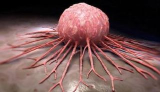 الأسبرين يمنع انتشار الخلايا السرطانية