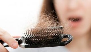 تساقط الشعر 