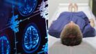 إنجاز علمي.. اكتشاف السبب الرئيسي للتوحد