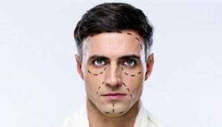 عمليات التجميل تصل لـ20% من الرجال العرب