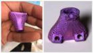 نجاح استبدال فقرات بالعمود الفقري بأخرى مستنسخة 3D