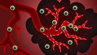 خلايا سرطانية