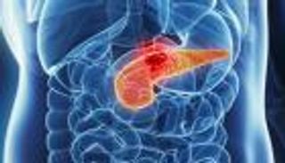 عقار جديد يطيل فترة صمود مرضى سرطان البنكرياس