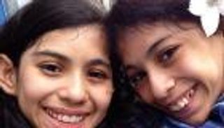 بالصور.. سابقة نادرة.. توأم ملتصق ترفضان الانفصال