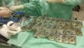 بالفيديو.. امرأة تبتلع 7 آلاف دولار انتقاما من زوجها