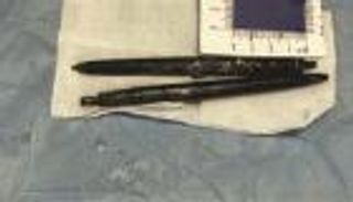 إزالة قلمين من أمعاء رجل ابتلعهما قبل 36 عاما