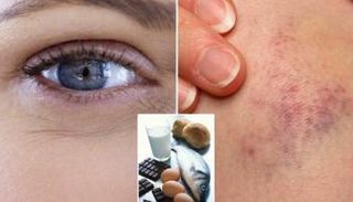 علامات على الوجه تحذرنا من بعض الأمراض