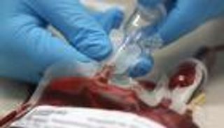 بعد تجارب 20 عاما.. حلم تصنيع الدم يقترب 