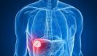 6 حقائق عن مرض" الكبد الدهني" القاتل الصامت