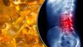 هل تعاني من آلام الظهر؟ هذا الفيتامين الطبيعي قادر على مقاومتها