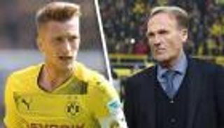 دورتموند يظهر العين الحمراء لنجومه عبر إقالة توخيل