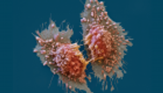 تطوير عقار يفكك الخلايا السرطانية