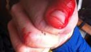 إصابة بريطاني في أول هجوم لأسماك القرش