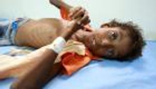 رمضان اليمن والحوثيين .. من نجا من الكوليرا مات جوعا