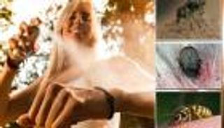 كيف تتجنب لدغات الحشرات في العطلات؟