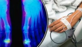 نظام المناعة يهاجم الجسم أحيانا