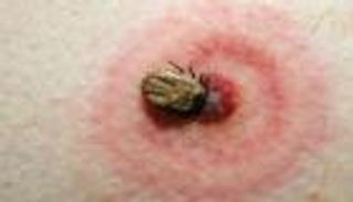 "عضة قط" تودي بحياة امرأة يابانية