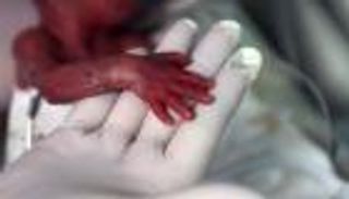 إنجاز علمي أمريكي يمنع انتقال جينات مسببة للأمراض لأجيال قادمة