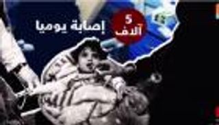 أكثر من نصف مليون إصابة بالكوليرا في اليمن 