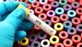 الهند الأولى في وفيات الأطفال بسبب السل