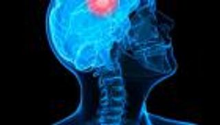 مفاجأة مذهلة.. فيروس زيكا يعالج سرطان المخ