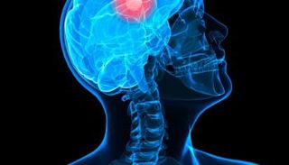 استغلال زيكا لغرض علاجي