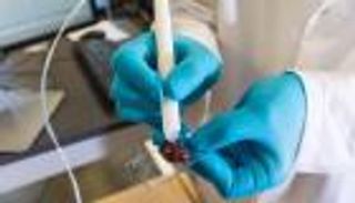 جهاز جديد لاكتشاف السرطان في 10 ثوان