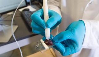 جهاز جديد يمكنه تشخيص مرض السرطان