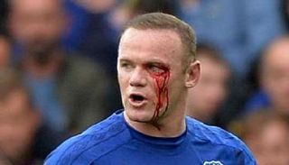 بالصور.. الإصابة تجبر روني على مغادرة موقعة بورنموث