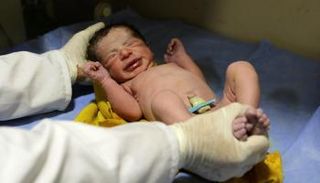 الولادة القيصرية قد تحرم طفلك من الرضاعة الطبيعية