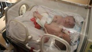 حنين وفرح بعد ولادتهما