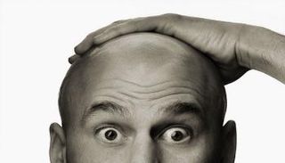 هندي ينتحر بسبب تساقط شعره 