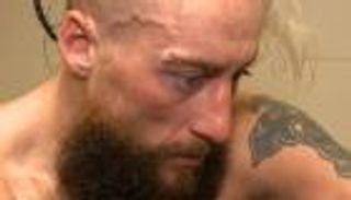 4 غُرز في وجه إنزو أموري بعد نزال ألكساندر