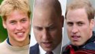 وداعا لشعر الأمير ويليام