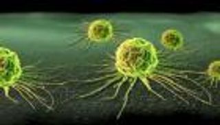 الجاليوم المشعة.. أحدث وسيلة لاكتشاف سرطان البروستاتا