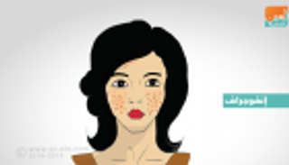 إنفوجراف.. 7 حلول طبيعية لحماية البشرة من حب الشباب